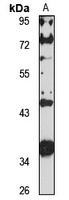 ZSCAN1 Rabbit Polyclonal Antibody