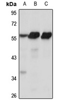 ZSCAN21 Rabbit Polyclonal Antibody