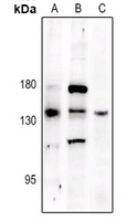 PERK (Phospho-T982) Rabbit Polyclonal Antibody