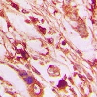 PERK (Phospho-T982) Rabbit Polyclonal Antibody