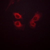 Beta Amyloid Antibody