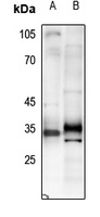Adiponectin Antibody