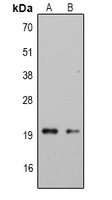 CMTM6 Rabbit Polyclonal Antibody