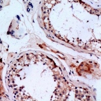 CMTM6 Rabbit Polyclonal Antibody