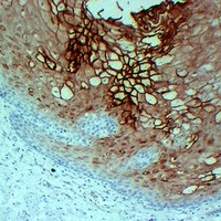 Annexin A1 Mouse Monoclonal Antibody