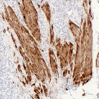 Calponin 1 Antibody