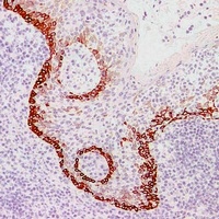 Cytokeratin 15 Antibody