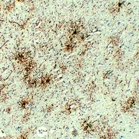 GFAP Antibody