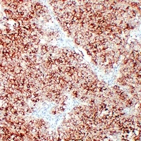 ALPP Mouse Monoclonal Antibody