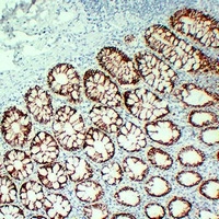 ALK5 Mouse Monoclonal Antibody