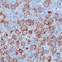 CD61 Mouse Monoclonal Antibody