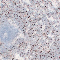 CD61 Mouse Monoclonal Antibody
