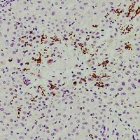 CD61 Mouse Monoclonal Antibody