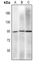 MLH1 Mouse Monoclonal Antibody