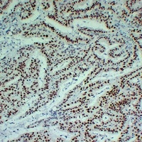 MLH1 Mouse Monoclonal Antibody