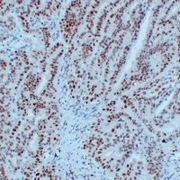 MLH1 Mouse Monoclonal Antibody