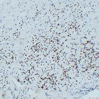 MYOD1 Mouse Monoclonal Antibody