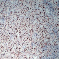 Wilms Tumor 1 Mouse Monoclonal Antibody