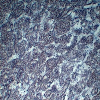 Wilms Tumor 1 Mouse Monoclonal Antibody
