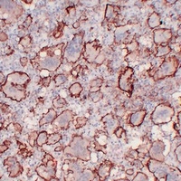 CD61 Mouse Monoclonal Antibody