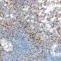 CD61 Mouse Monoclonal Antibody