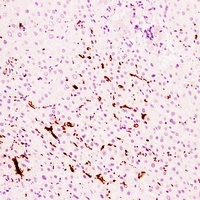 CD61 Mouse Monoclonal Antibody