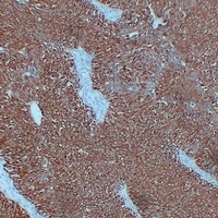 Cytokeratin 7 Antibody