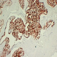 Cytokeratin 7 Antibody