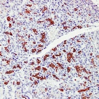 Cytokeratin 7 Antibody