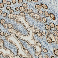 Claudin 3 Mouse Monoclonal Antibody