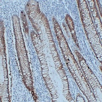 Claudin 3 Mouse Monoclonal Antibody
