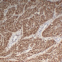 Desmin Mouse Monoclonal Antibody