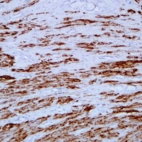 Desmin Mouse Monoclonal Antibody