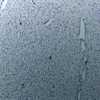 TPSAB1 Antibody