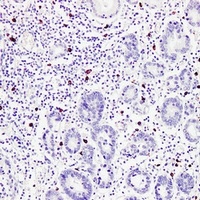 TPSAB1 Antibody