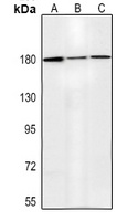 MSH6 Mouse Monoclonal Antibody