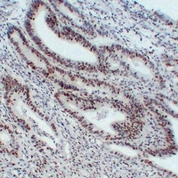 MSH6 Mouse Monoclonal Antibody