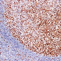 MSH6 Mouse Monoclonal Antibody