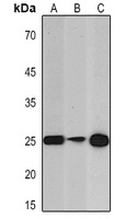 PGP9.5 Mouse Monoclonal Antibody