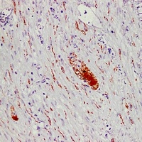 PGP9.5 Mouse Monoclonal Antibody