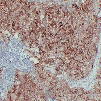ALPP Mouse Monoclonal Antibody