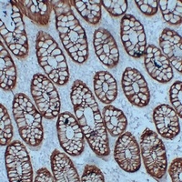 Villin Mouse Monoclonal Antibody