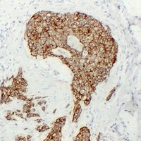 Cadherin pan Antibody