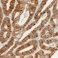 Cadherin pan Antibody