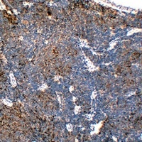Chromogranin A Mouse Monoclonal Antibody