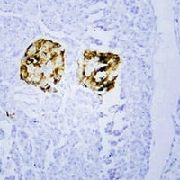 Chromogranin A Mouse Monoclonal Antibody