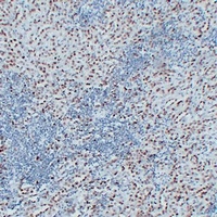 Wilms Tumor 1 Mouse Monoclonal Antibody