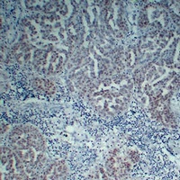 Wilms Tumor 1 Mouse Monoclonal Antibody
