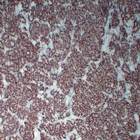 Wilms Tumor 1 Mouse Monoclonal Antibody
