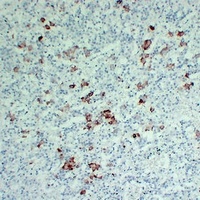 Thyrotropin beta Mouse Monoclonal Antibody